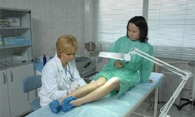 comment traiter les varices sur les jambes